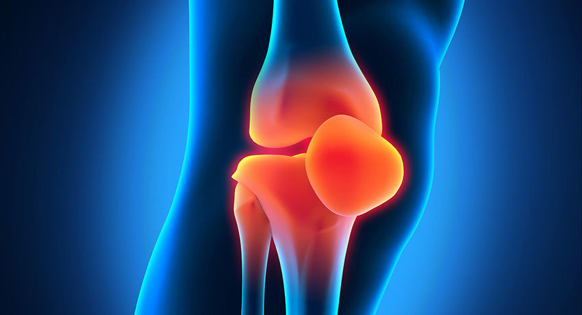 Поражение коленного сустава