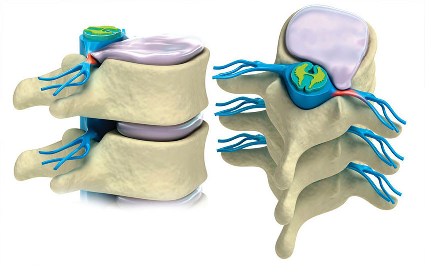 Строение позвоночника
