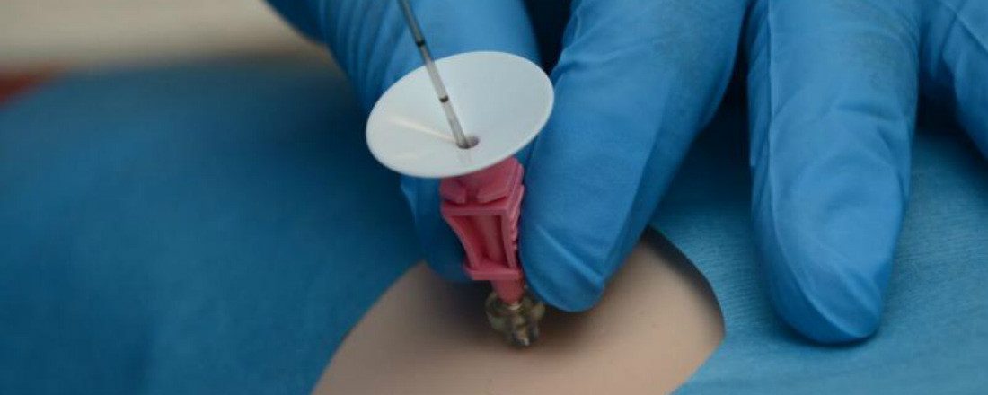 Биопсия и наркоз