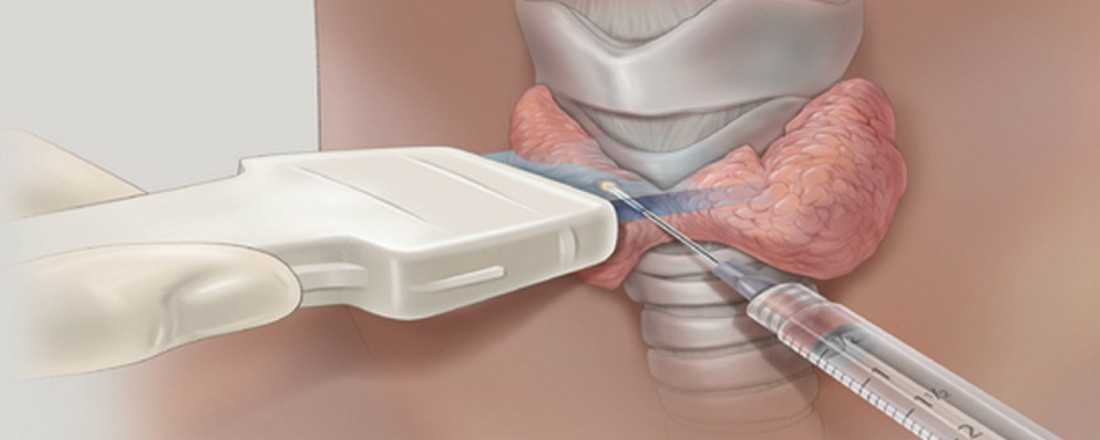 Больно ли делать биопсию различных органов?