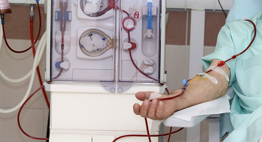 Плазмаферез