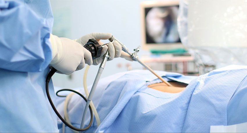 Торакоскопическая пневмоэктомия