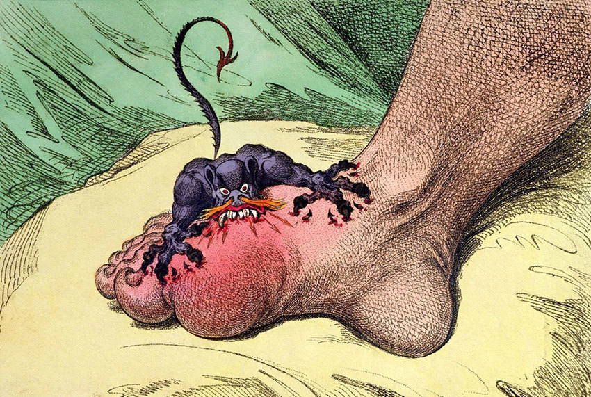 Карикатура о подагре