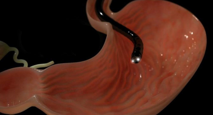 Исследование желудка