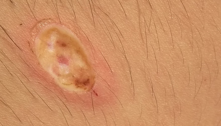 После удаления