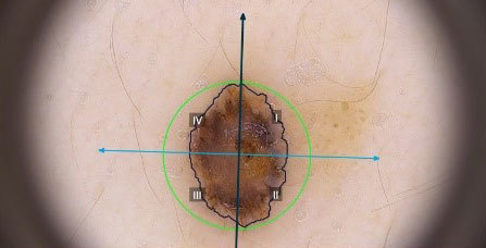 предварительная-диагностика-1-05112019