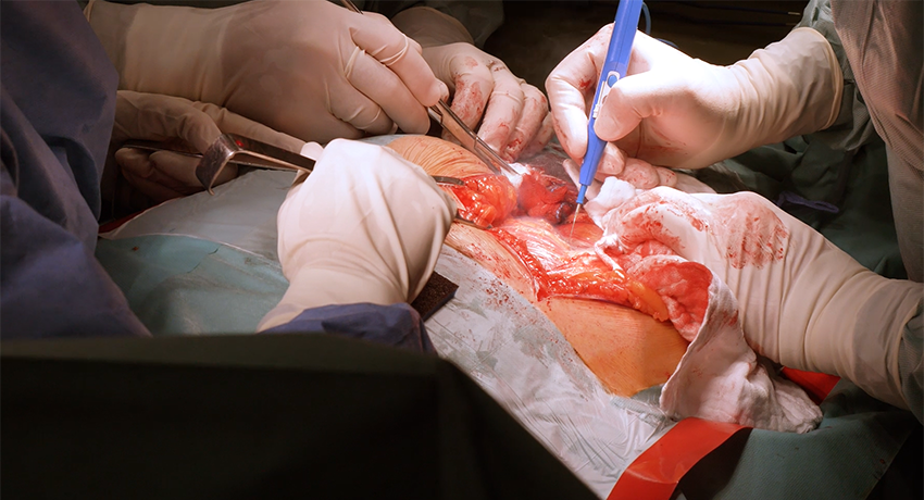 Хирургическая операция в международной клинике Медика24