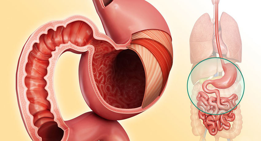 Рак 12-пёрстной кишки
