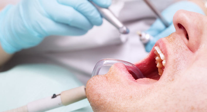 Диагностика полости рта