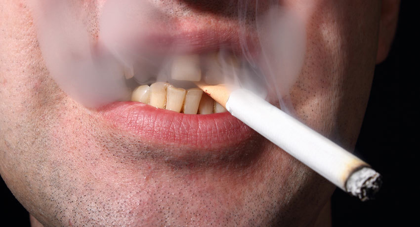 Курение вызывает рак нёба