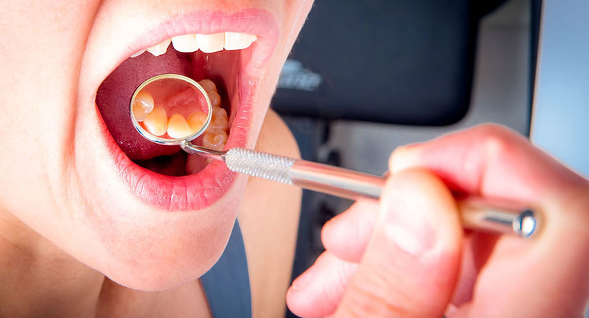 Диагностика рака нёба