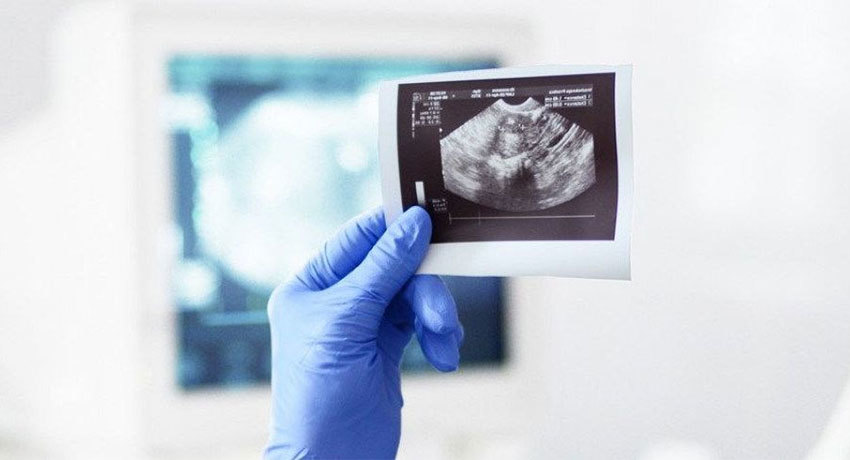 Рак селезенки