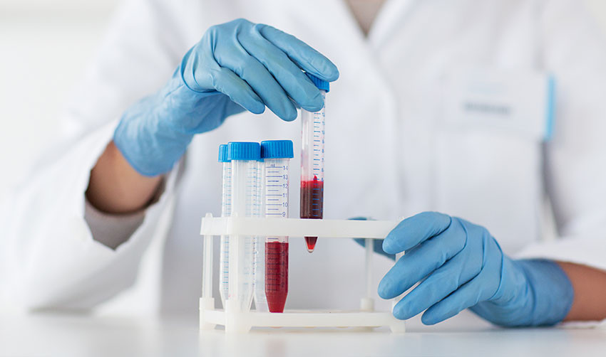 рак-толстой-200819-4