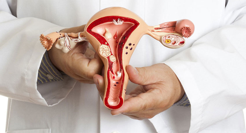 Рак влагалища