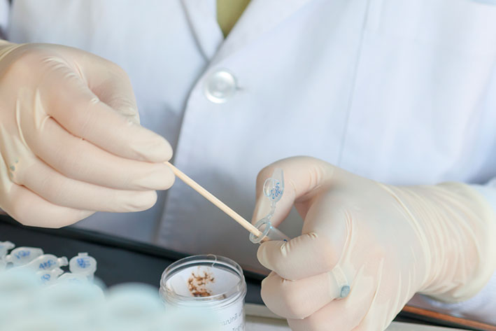 sindrom-razdrazhennogo-kishechnika-analiz