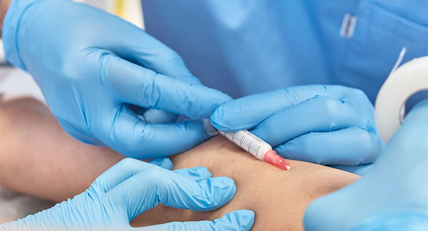 Склеротерапия в международной клинике Медика24