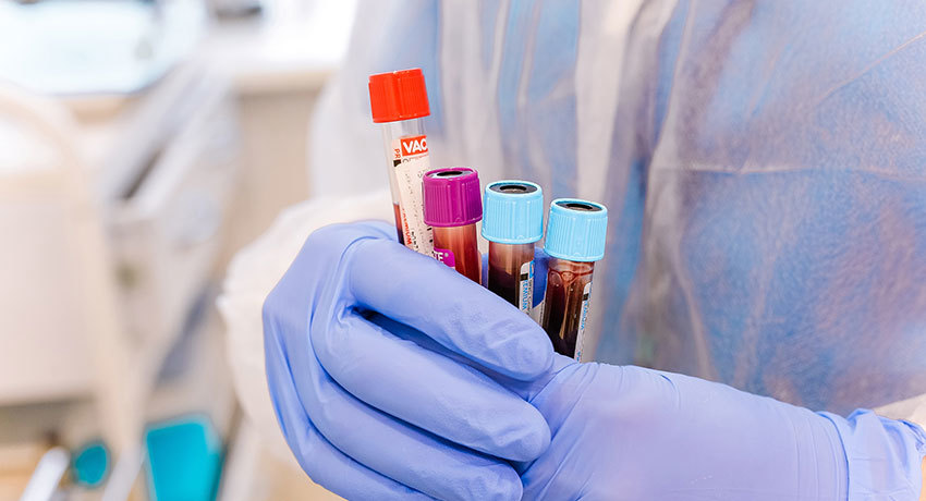 Молекулярно-генетические исследования для подбора таргетной терапии