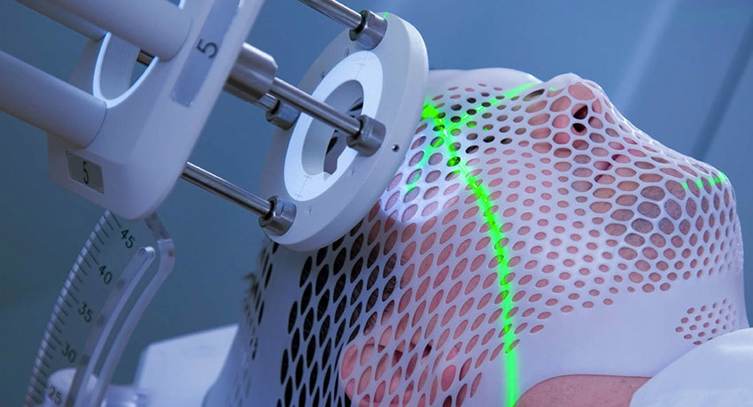 Лучевая терапия