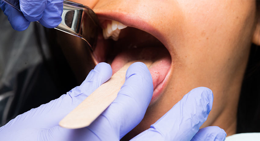 Диагностика рака языка