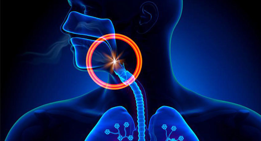 Показания к наложению трахеостомы