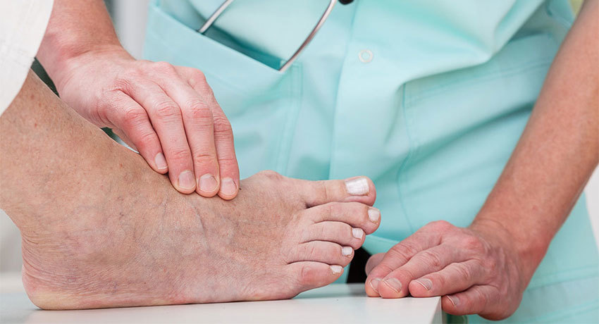 Лечение трофических язв