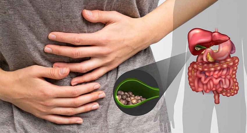 Желчнокаменная болезнь