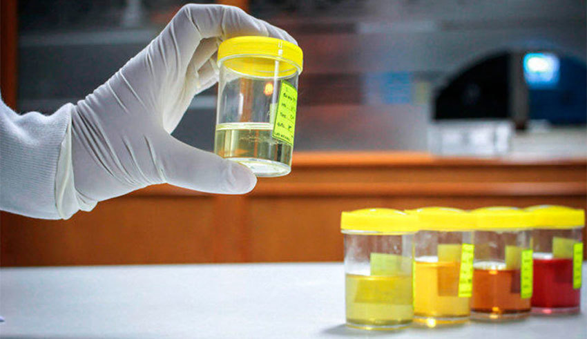 Анализ мочи в международной клинике Медика24