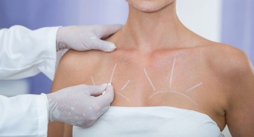 Увеличение груди