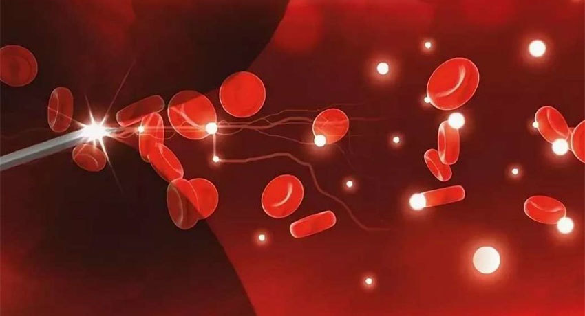 Внутривенное лазерное облучение крови