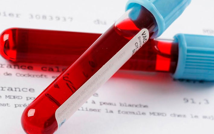 yazva-zheludka-analiz