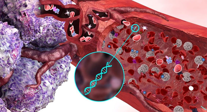 Жидкостная биопсия