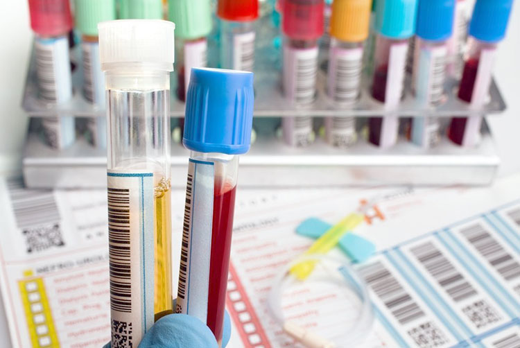 жизнь-после-рака-1-04-2019-3