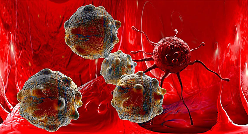 Лечение злокачественных опухолей