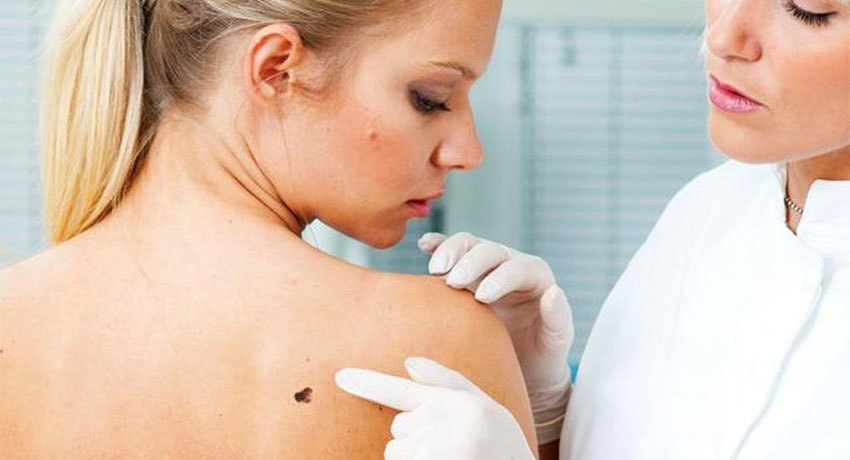 Злокачественные опухоли кожи